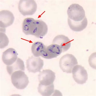  Babesia! Un parasite intraérythrocytaire capable d'infecter divers mammifères et de transmettre des maladies graves.